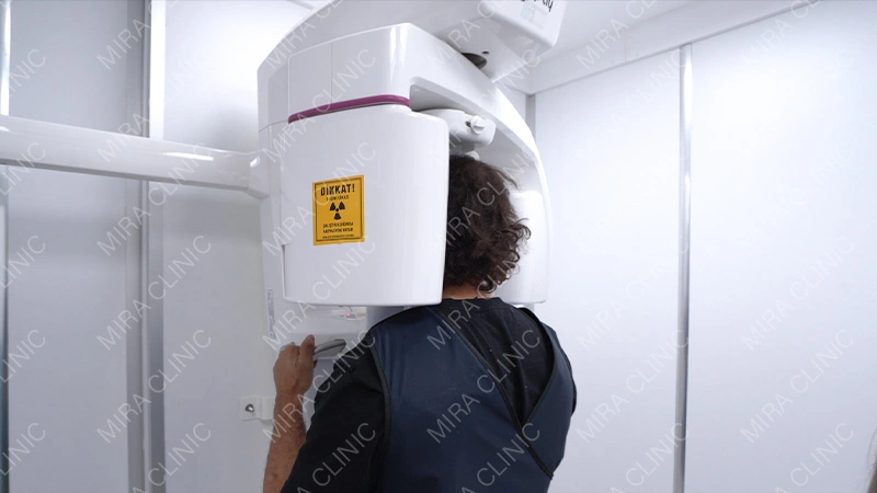 X-rays or CBCT if needed